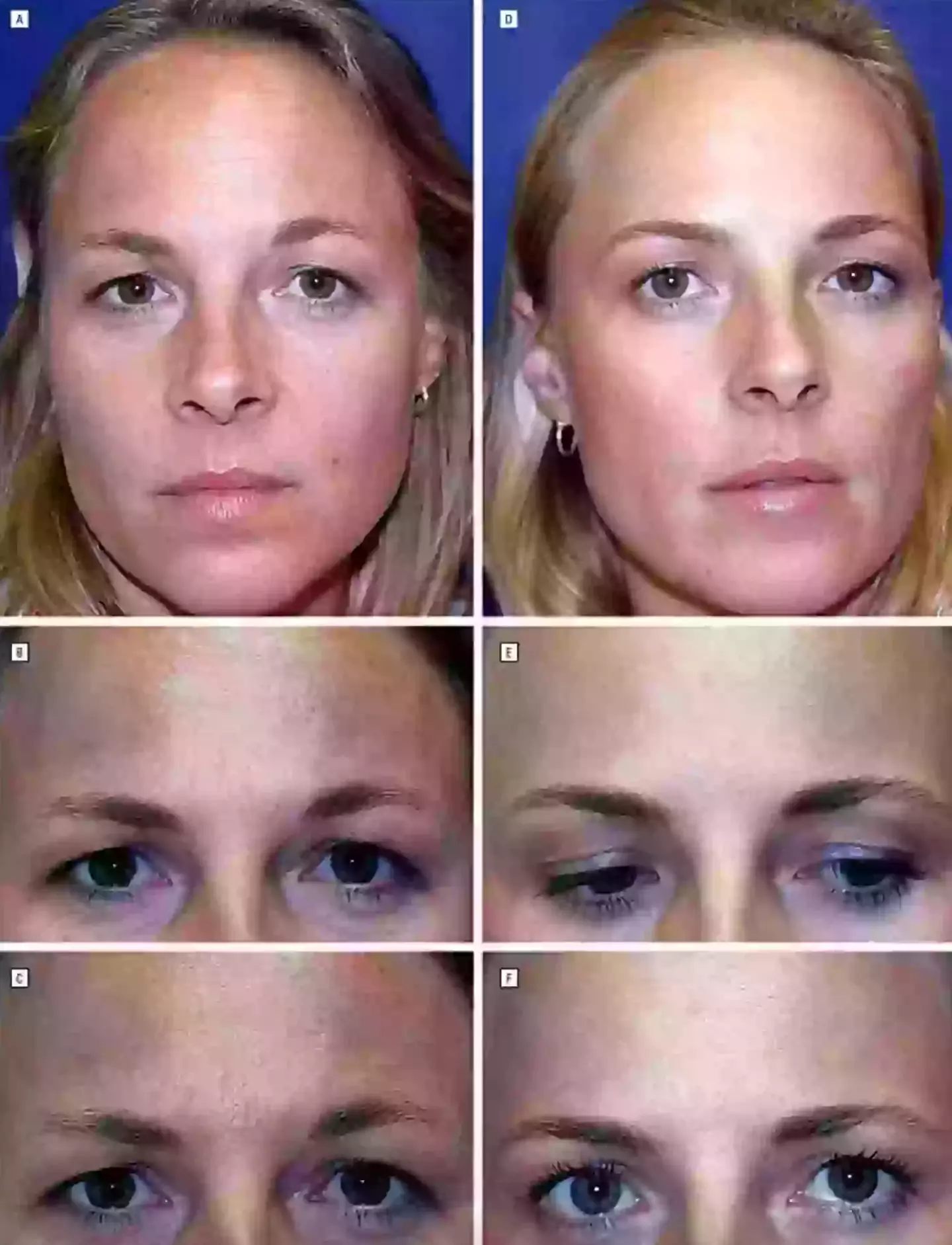 The twins underwent a lot of changes over the 20 years (American Medical Association)