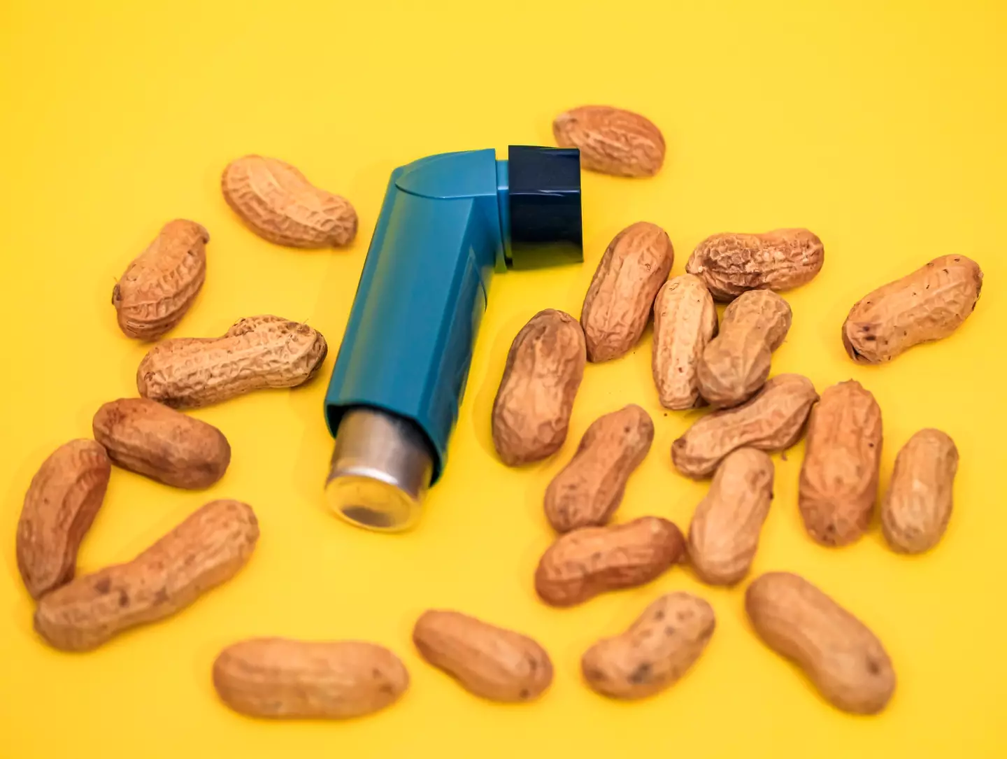 Peanut allergies can be incredibly serious.