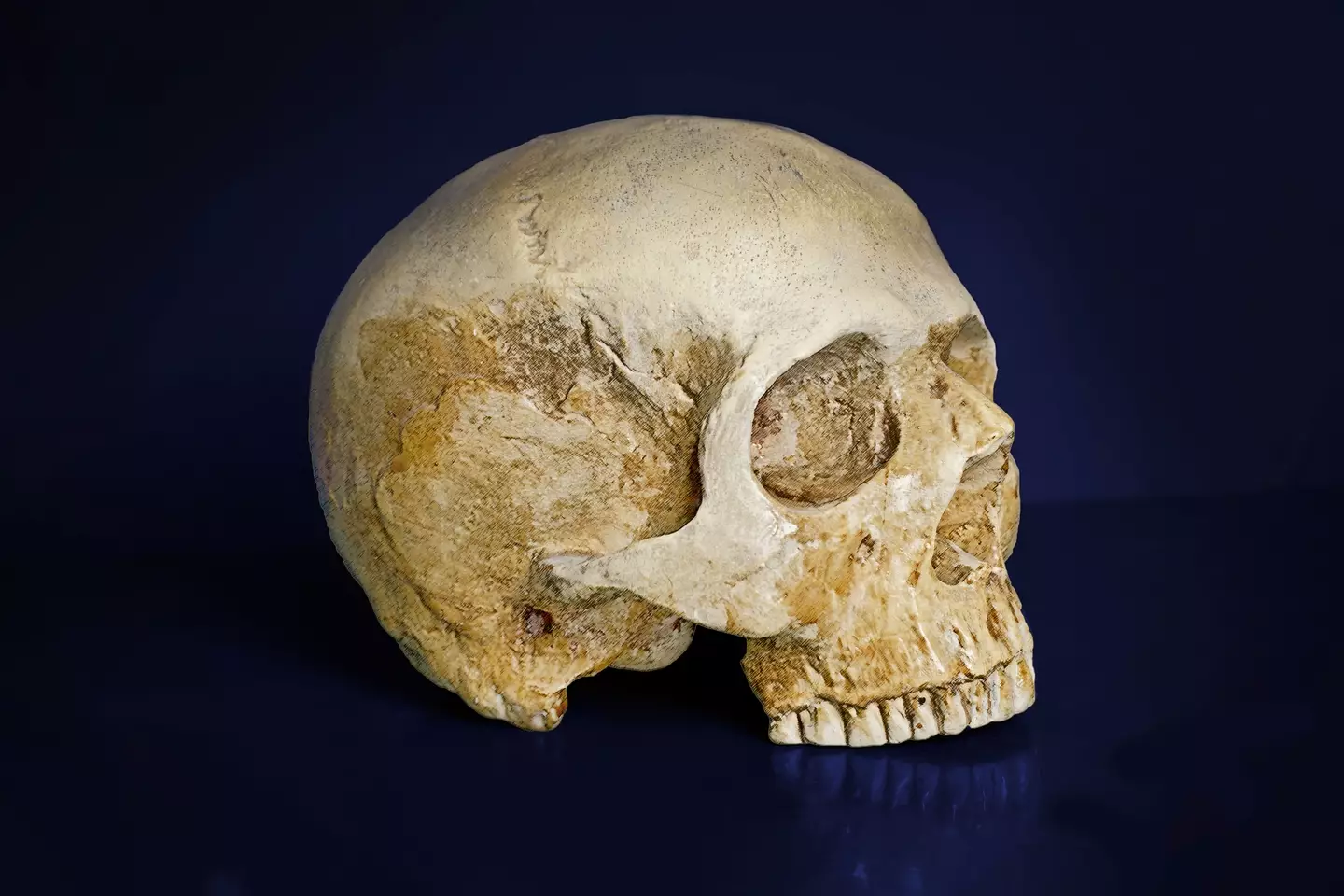 The skull does a top-notch job of keeping our brains from getting squished.