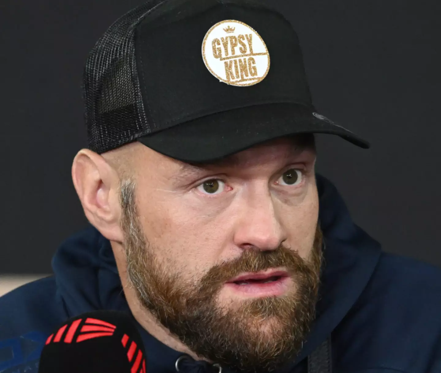 Tyson Fury's voice changed after he was punched in the throat.