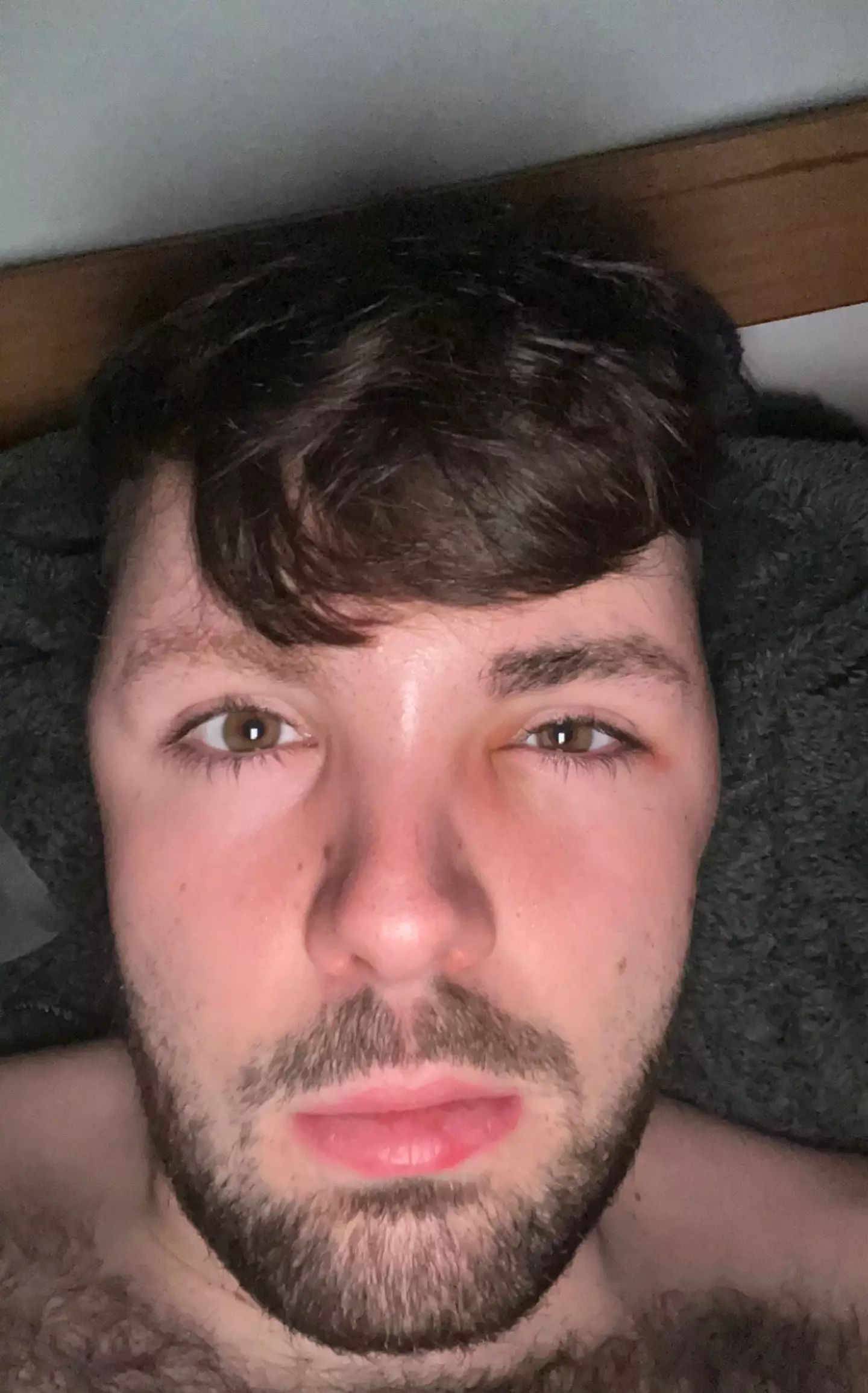Ruben's swelled head (SWNS)