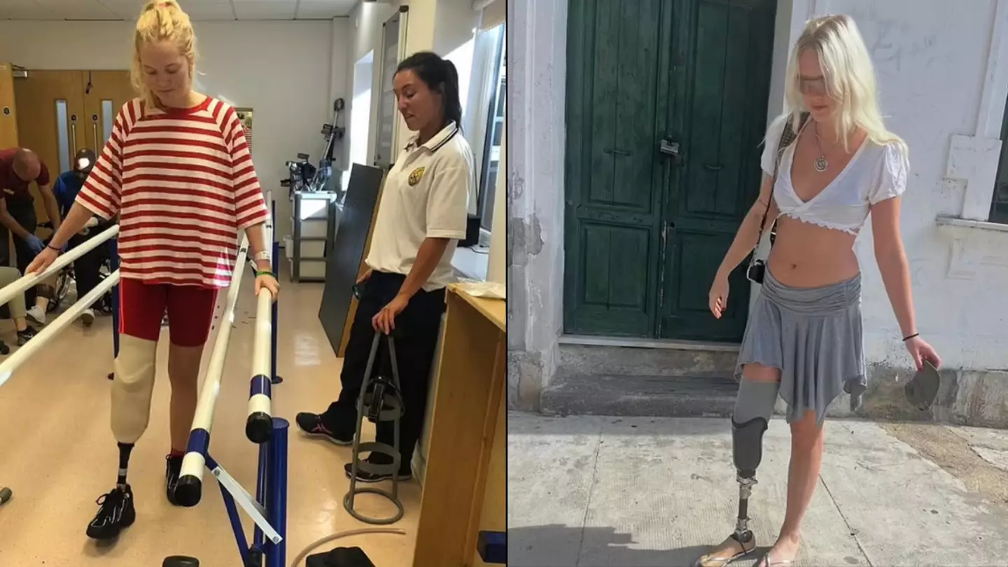 Woman who had leg amputated aged 22 after horror bus crash reveals what 'distinct voice in her head' said