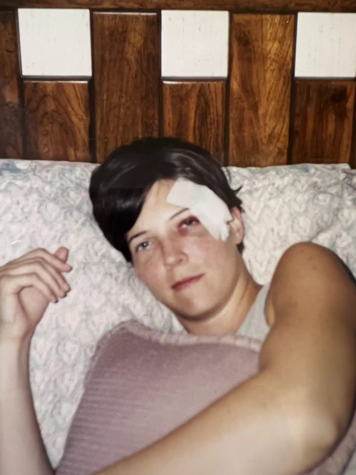 Her injuries have left lasting damage.