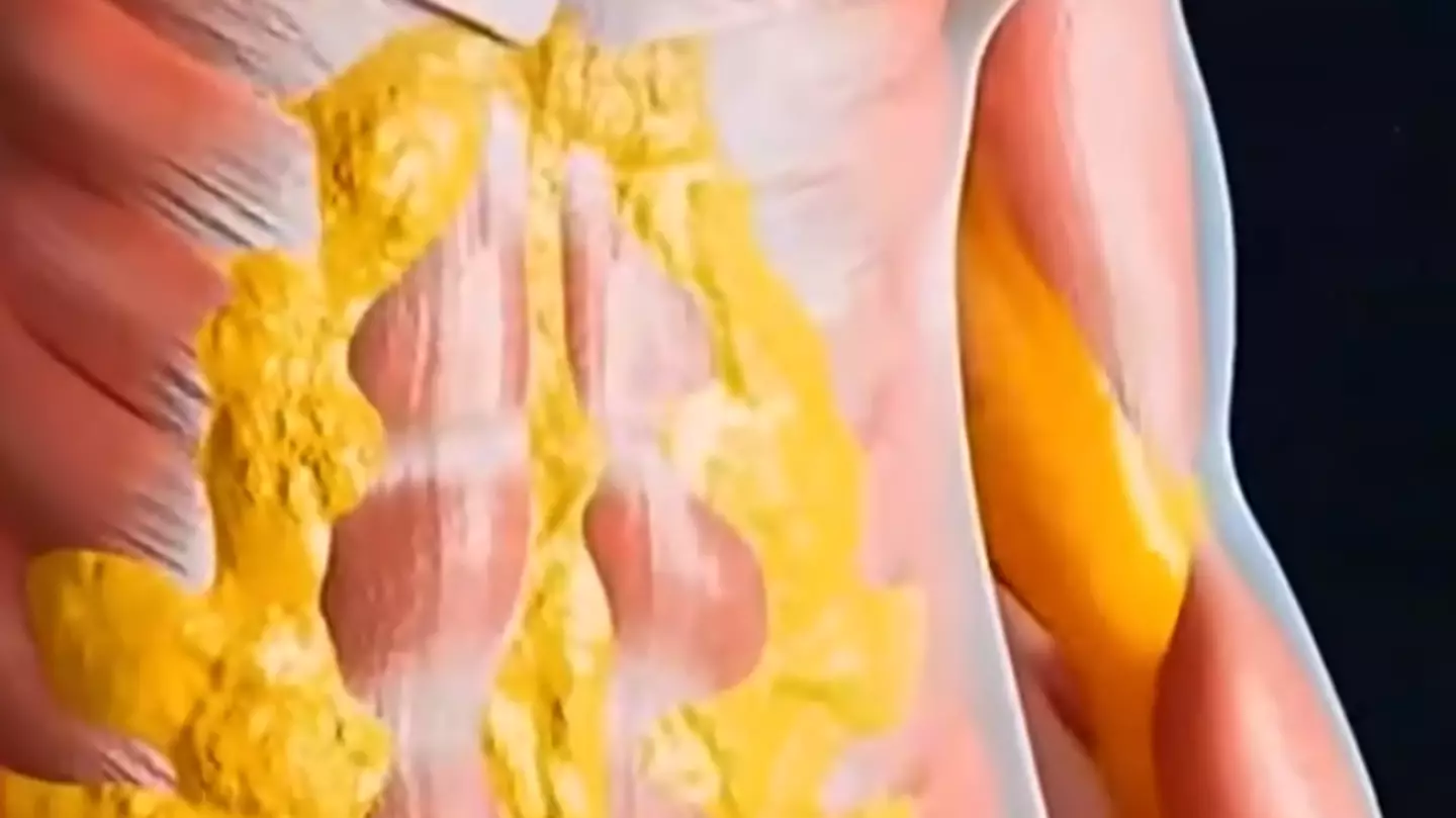 YouTube/Wellness Wise