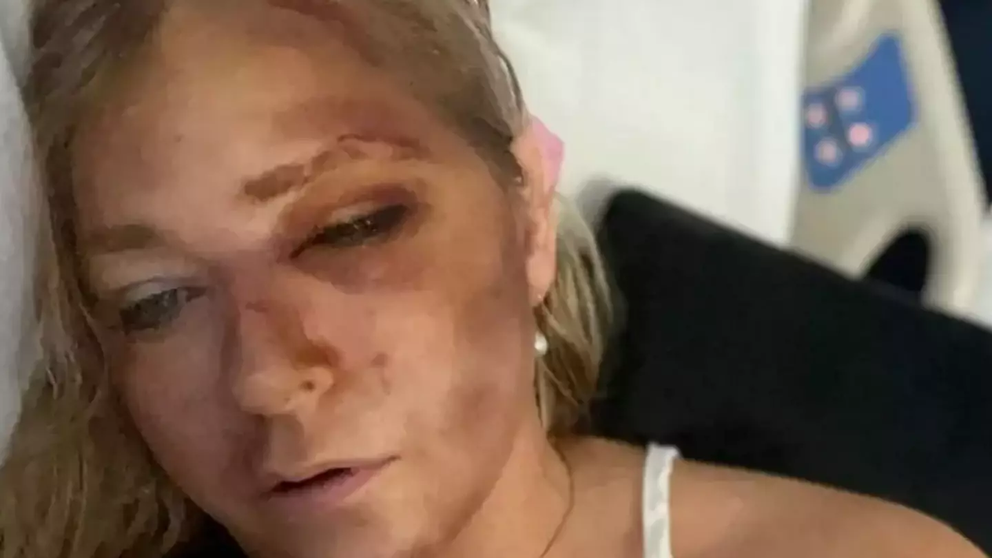 Woman who was driving Virginia Giuffre when bus crashed and left her with ‘days to live’ breaks silence on incident