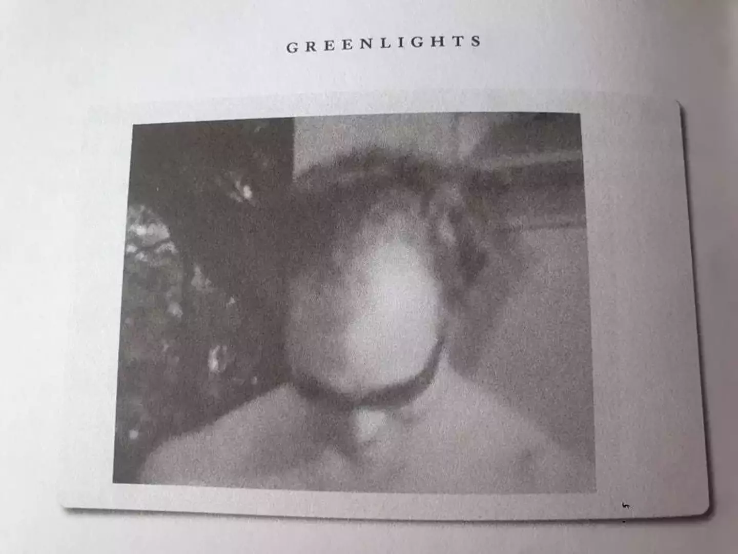 He opens up about his hair loss in his memoir, Greenlights.