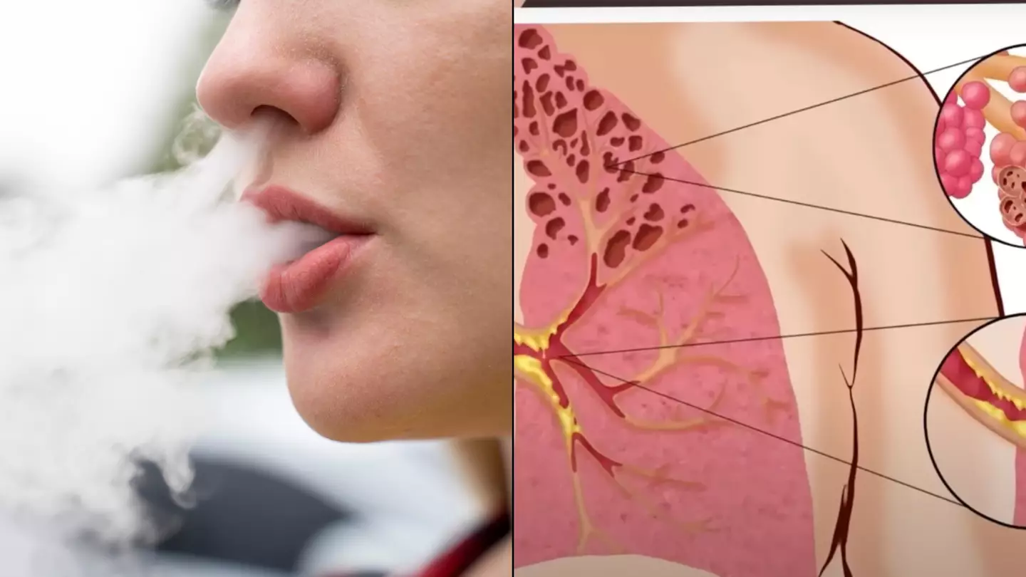 Sobering simulation shows what really happens to your body when you inhale smoke from a vape
