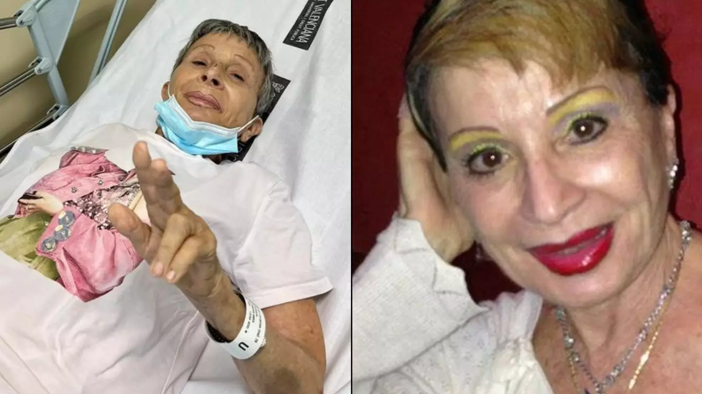 Retired Benidorm Legend Sticky Vicky Hospitalised