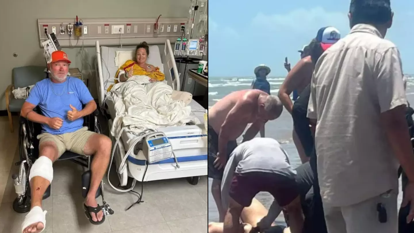 Woman has calf torn off in horrific shark attack after thinking it was 'huge fish'