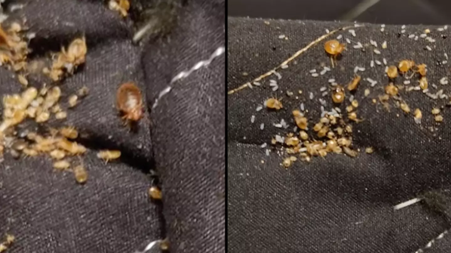 Disturbing video shows the reality of having bed bugs
