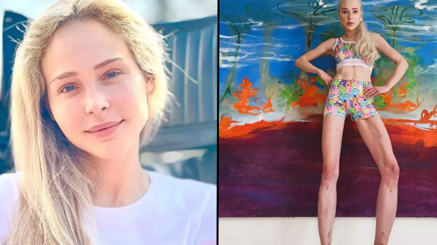 Woman who spent £130,000 on surgery to go from 5’6” to 6” explains why she regrets it