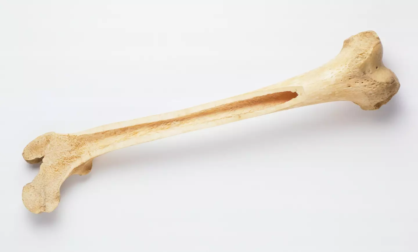 There was also a human thigh bone - again, not this one - up for auction.