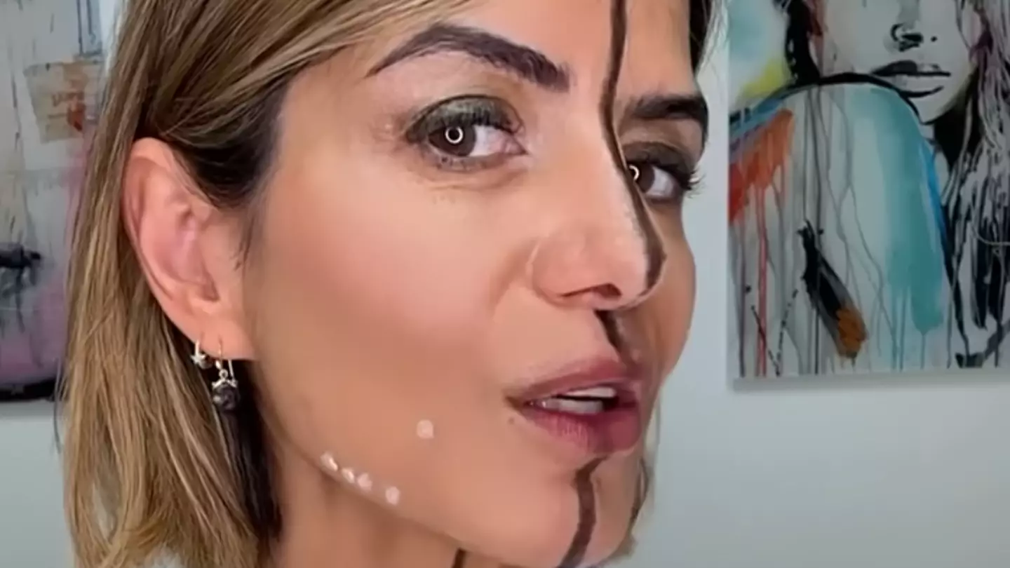 Long-term effects of Botox as woman only injects one half of her face to show what it does to her