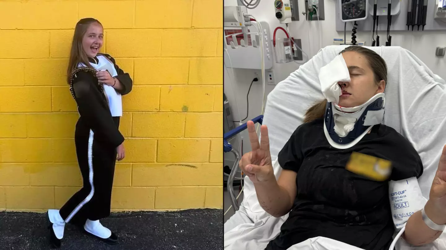 Teenager’s eye ‘exploded like grape’ in car crash after sun blinded her despite only driving at 10MPH