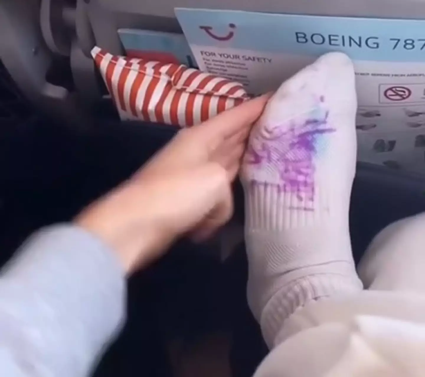 If you didn't want your socks to be a canvas then maybe don't take your shoes off.