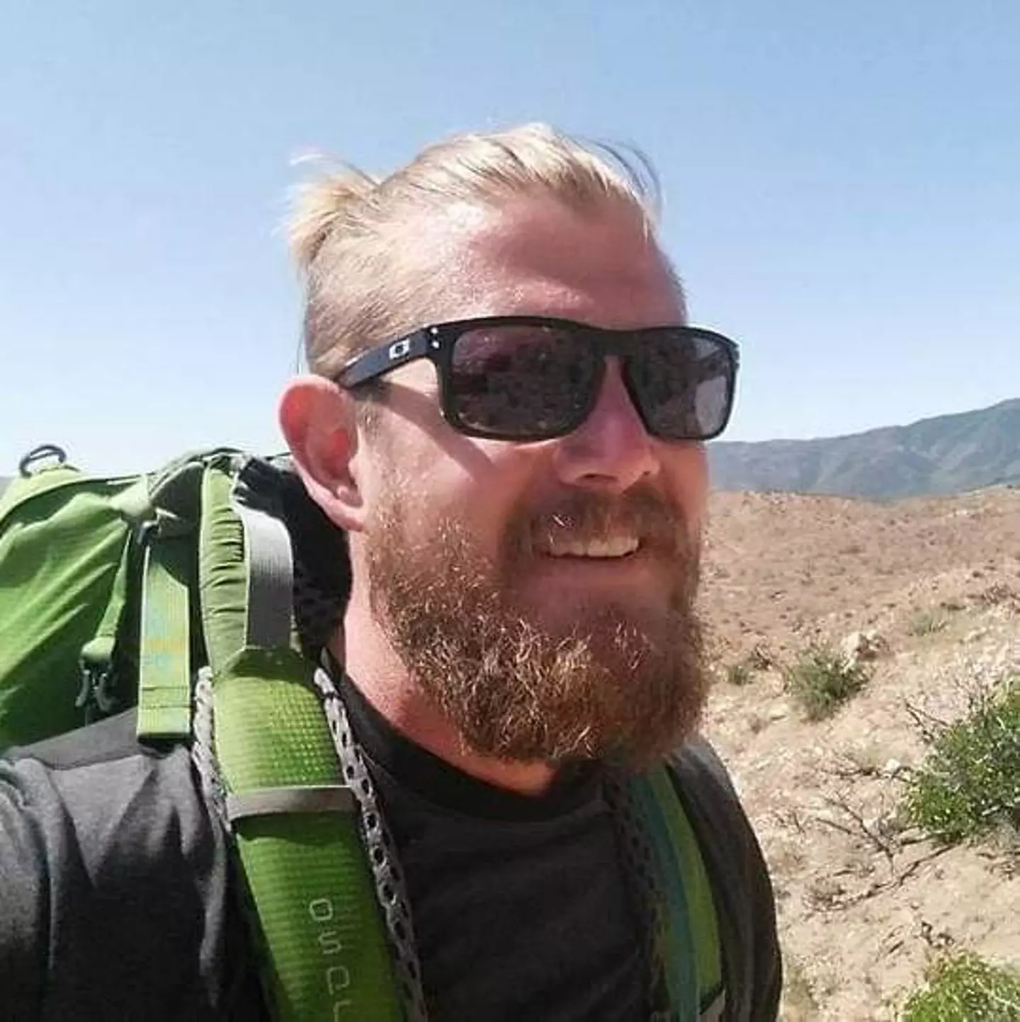 Doctors told Max's family there was a chance he might not make it (SWNS)
