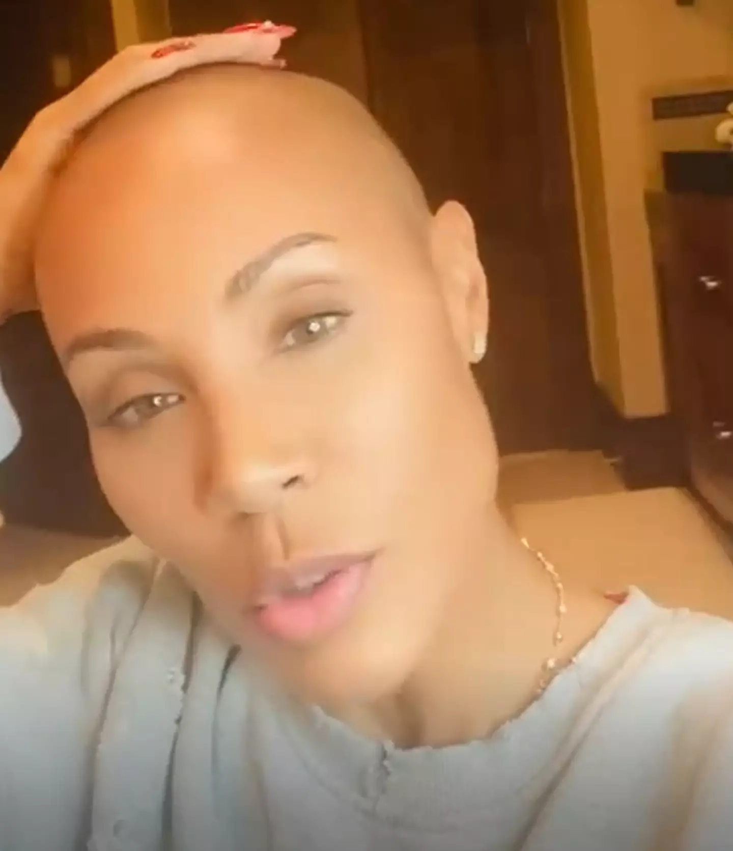 Pinkett Smith has been open about her alopecia.