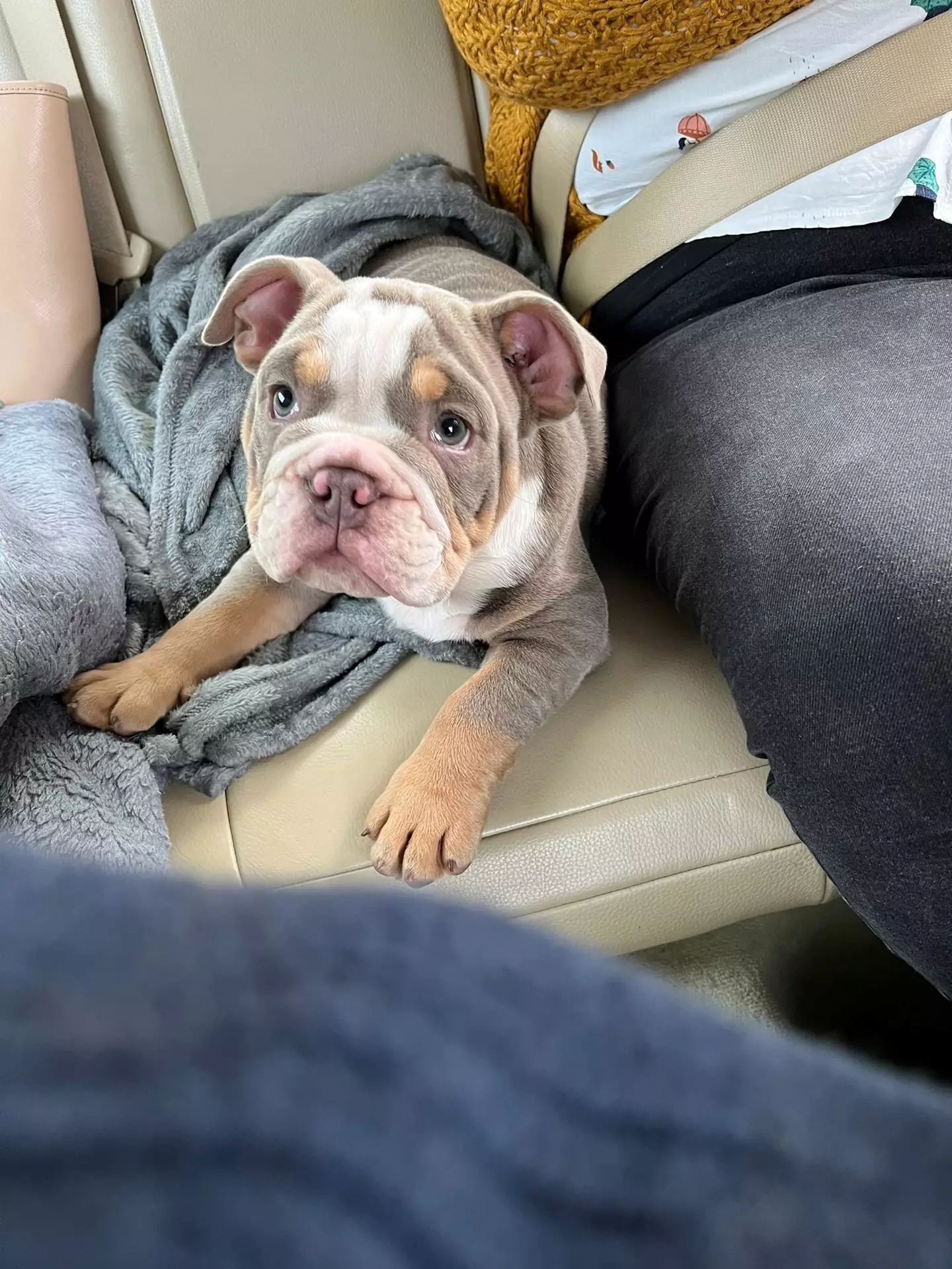 David's dog was just seven months old when it chewed his toe.