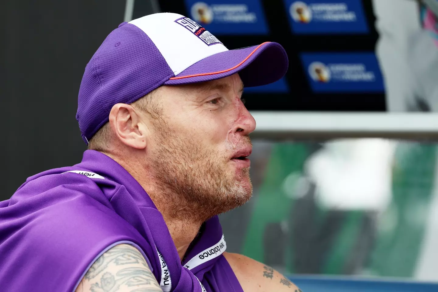 The injuries can still be seen on Flintoff's face. (Nigel Roddis - ECB/ECB via Getty Images)