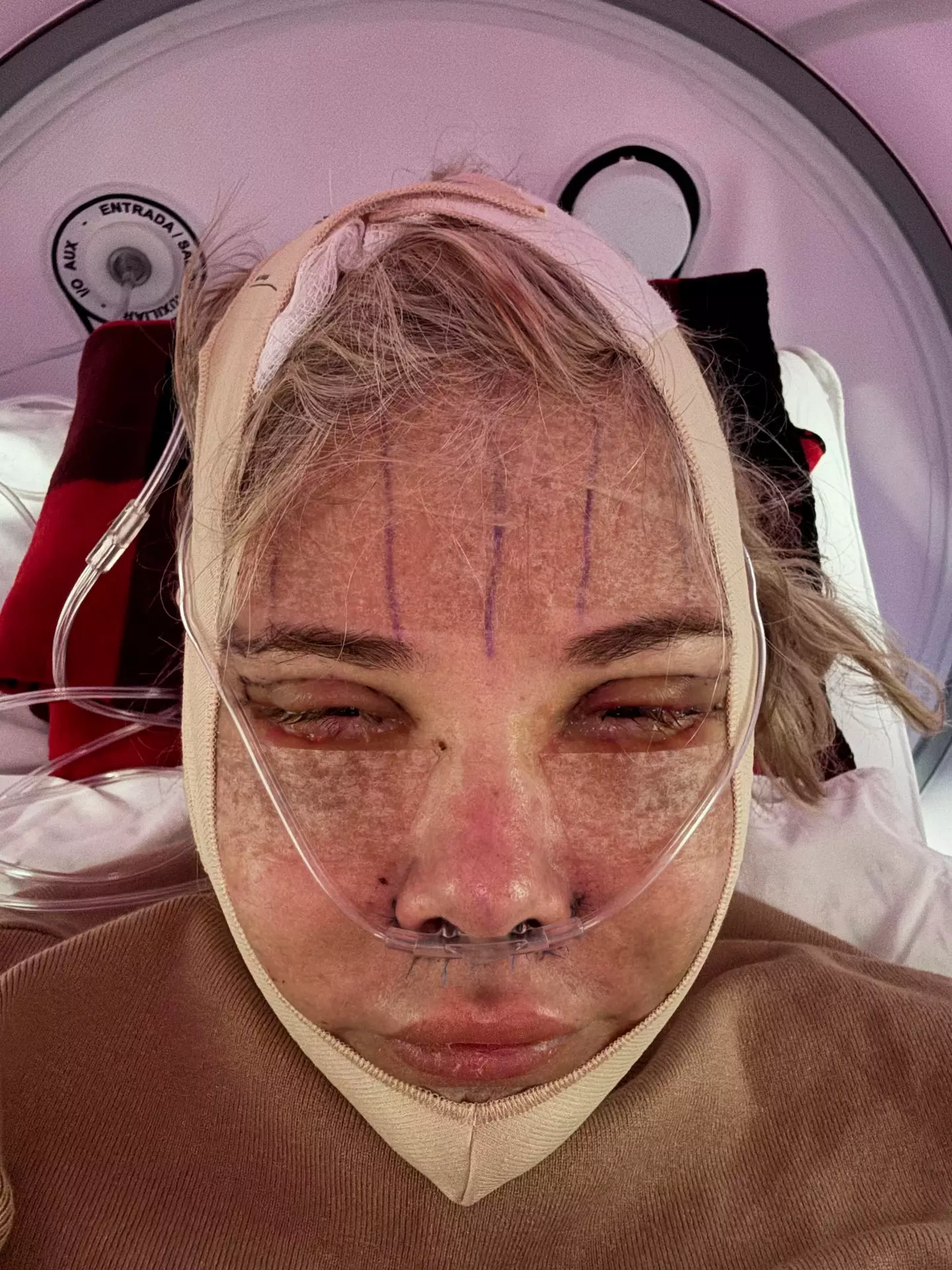 She underwent an array of procedures with a surgeon in Tijuana (PA Real Life)