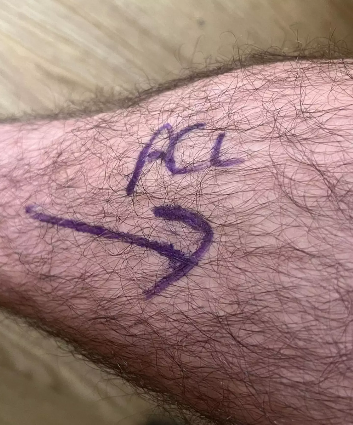 Halsall said the operation ‘went well’.