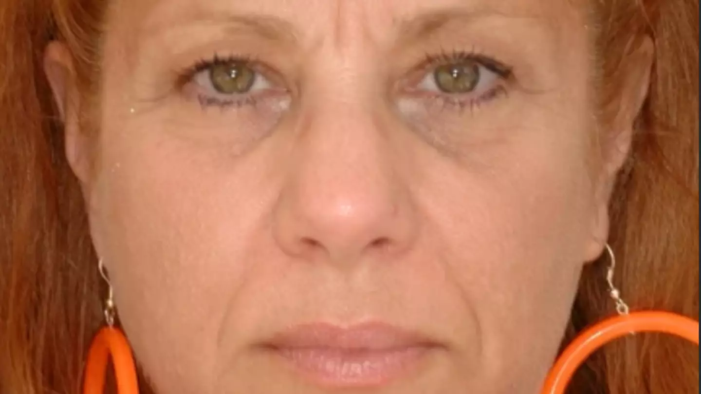 Identical twins show physical impact of stress after one had divorce and other didn’t