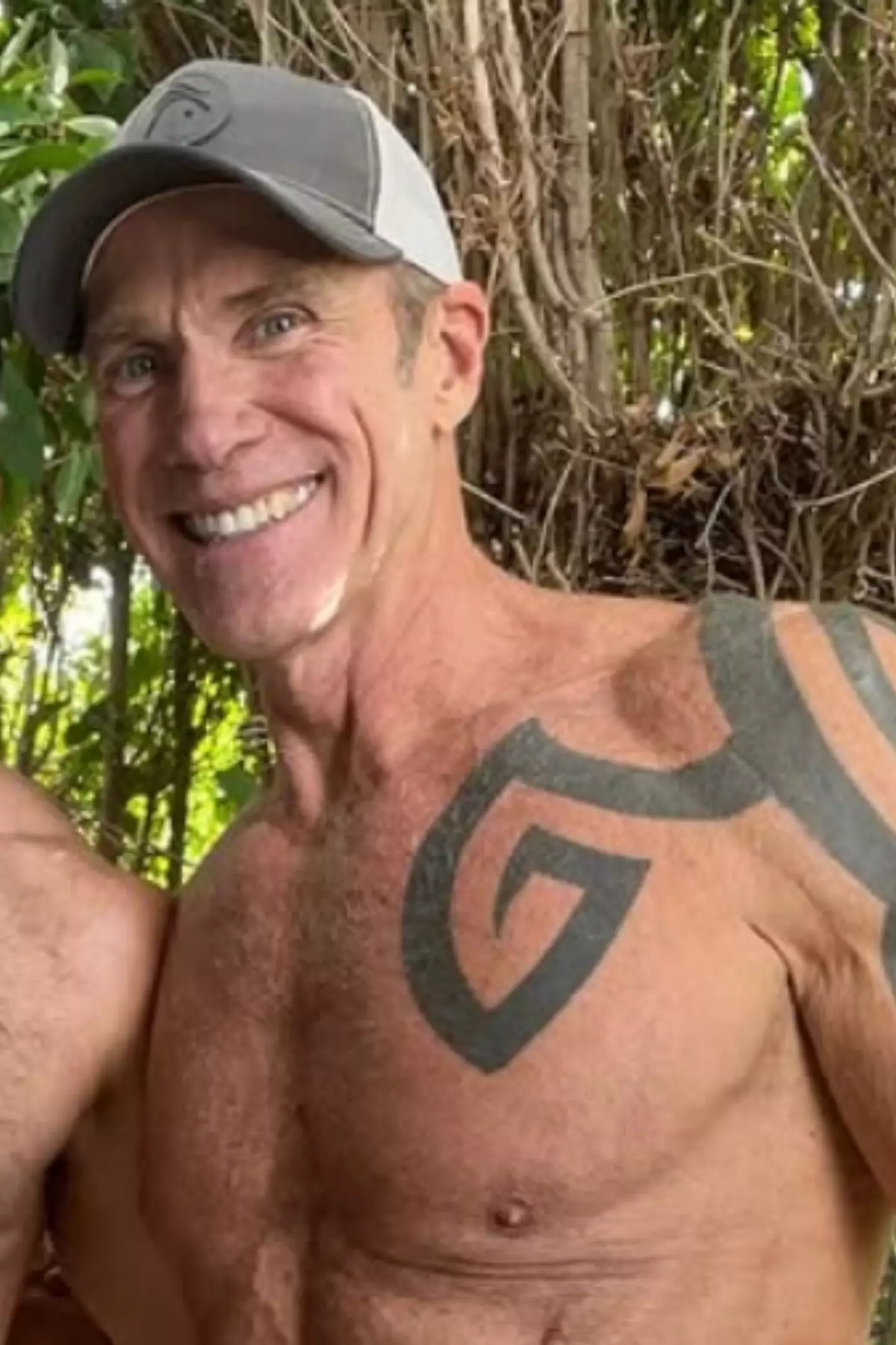 Dallas Steele said his only 'regret' was not getting the surgery sooner (Instagram/daddy_dallassteele)