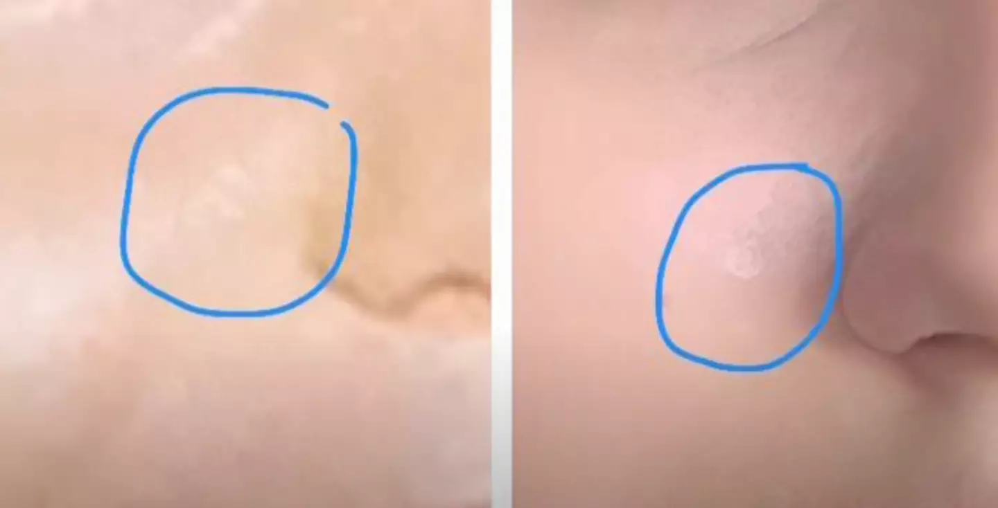 Wandelt claims she has the same scar as McCann (YouTube/Break The Ice)