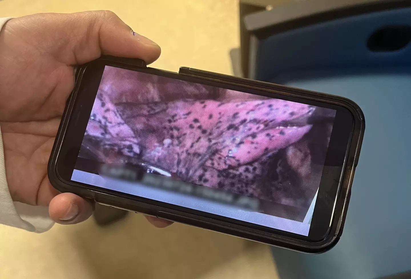 Sean was shown an image inside his lung, which was covered in black spots.
