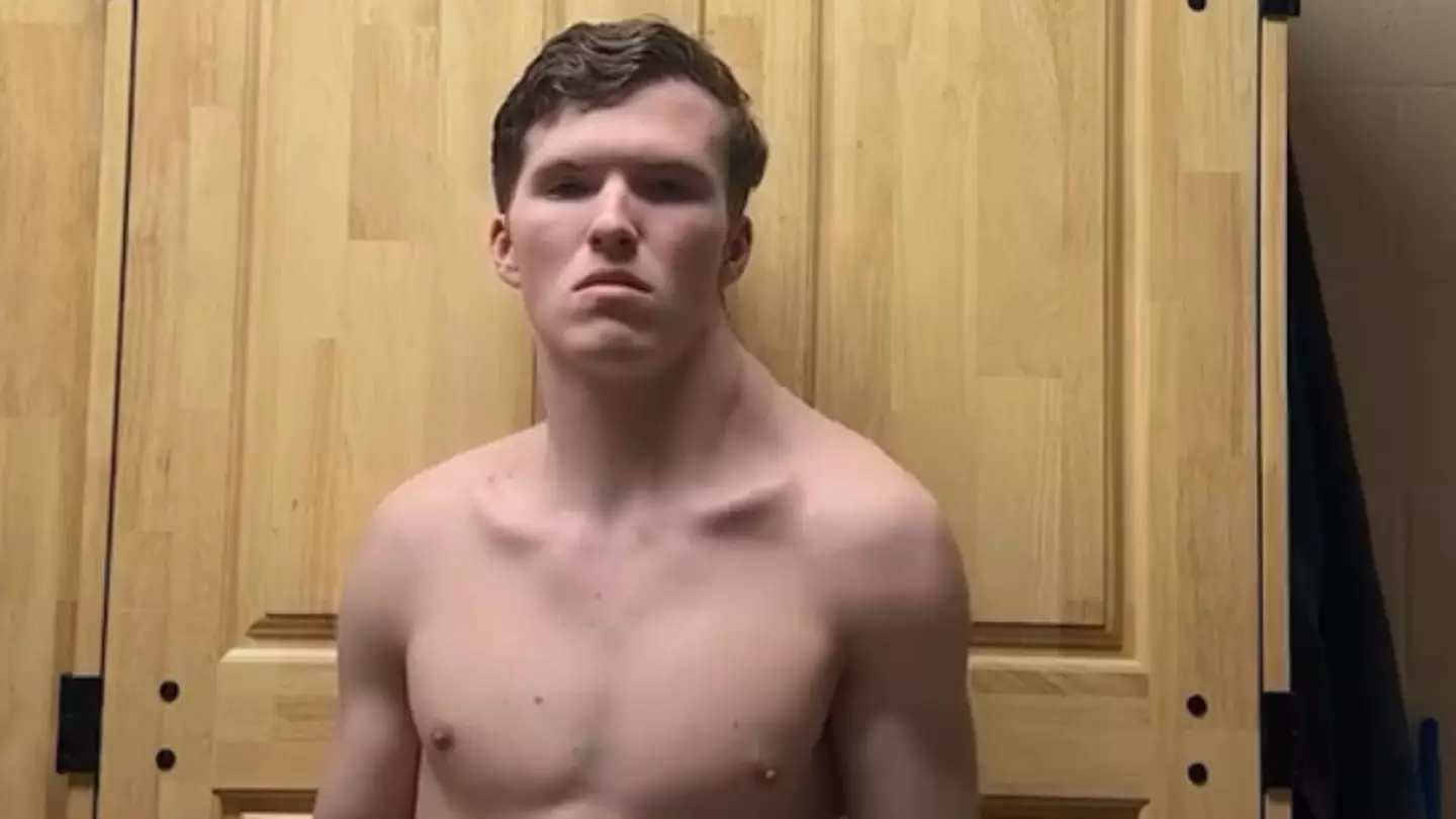 'Concerned' doctor issues long term health warning to lad who's only trained one trap for months