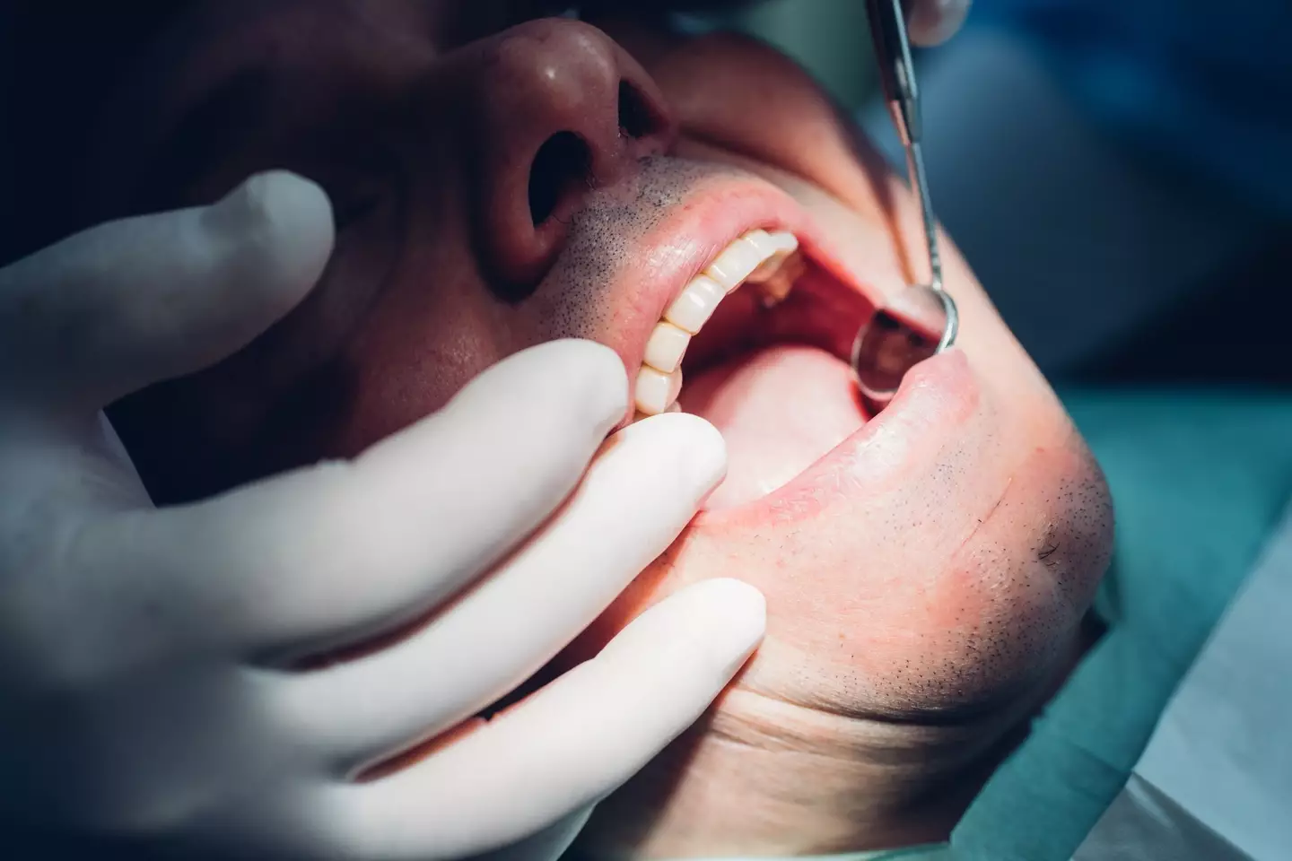 Gum disease has been linked with causing more serious diseases (Getty Stock Images)