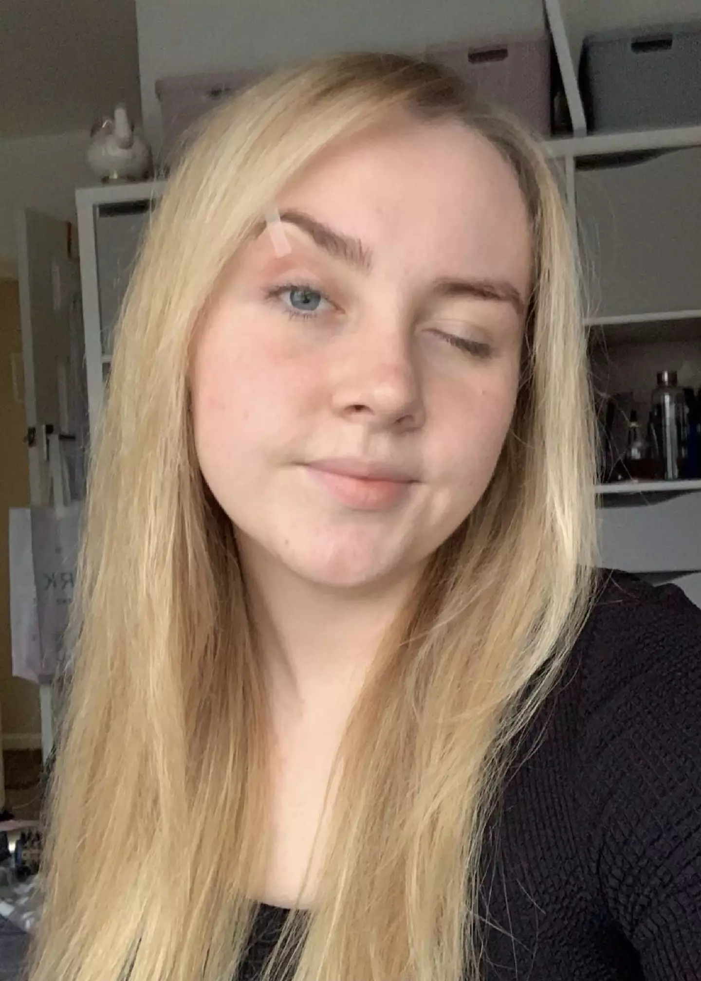Tia-Leigh Streamer developed the rare eye condition in May 2023, when she was 19-years-old (Kennedy News and Media)