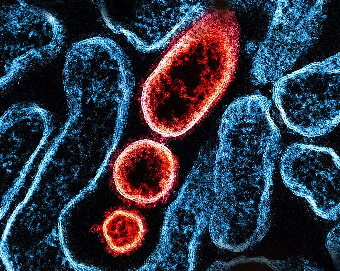 'Fever, headaches, myalgia (muscle pain), vomiting and sore throat' are the reported symptoms of Nipah virus (NIH-NIAID/Image Point FR/BSIP/Universal Images Group via Getty Images)