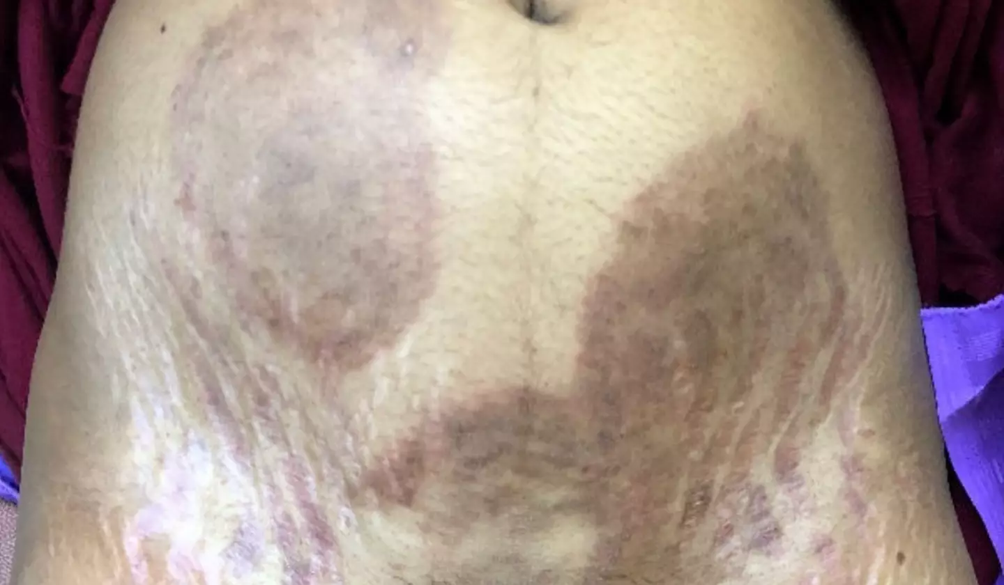 Experts warn it that the 'super fungus' is spreading (MDPI)