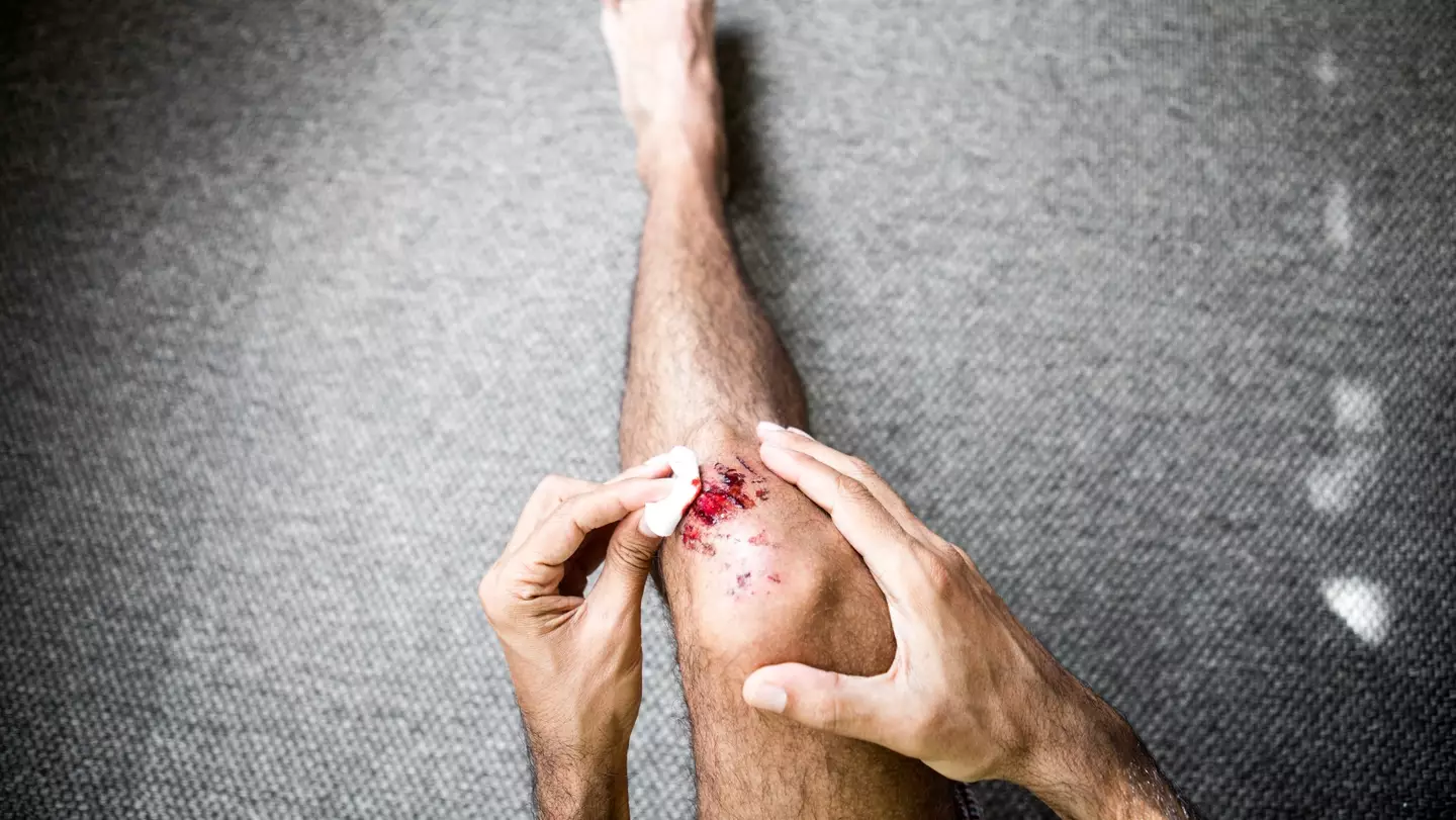 Haemophilia B is caused by a caused by a deficiency in a protein which allows our blood to clot (Getty Stock Image)