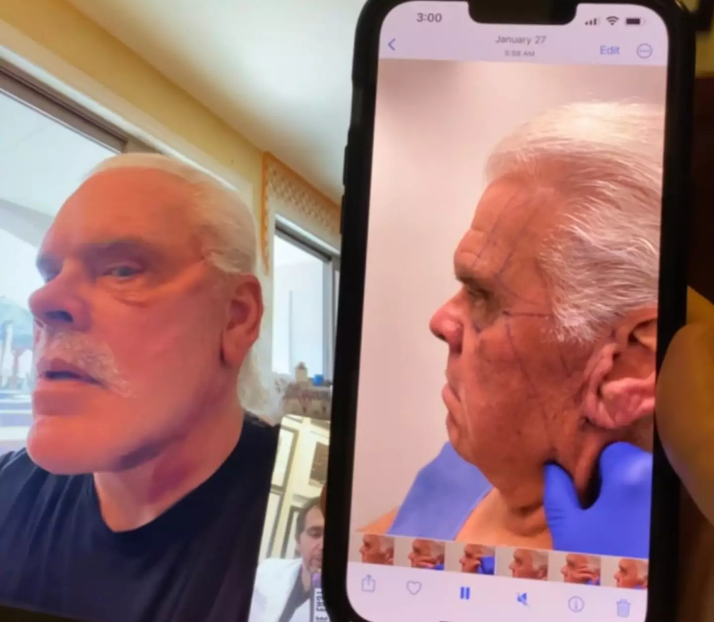 The man underwent a number of procedures to get the results (Kassir Plastic Surgery)