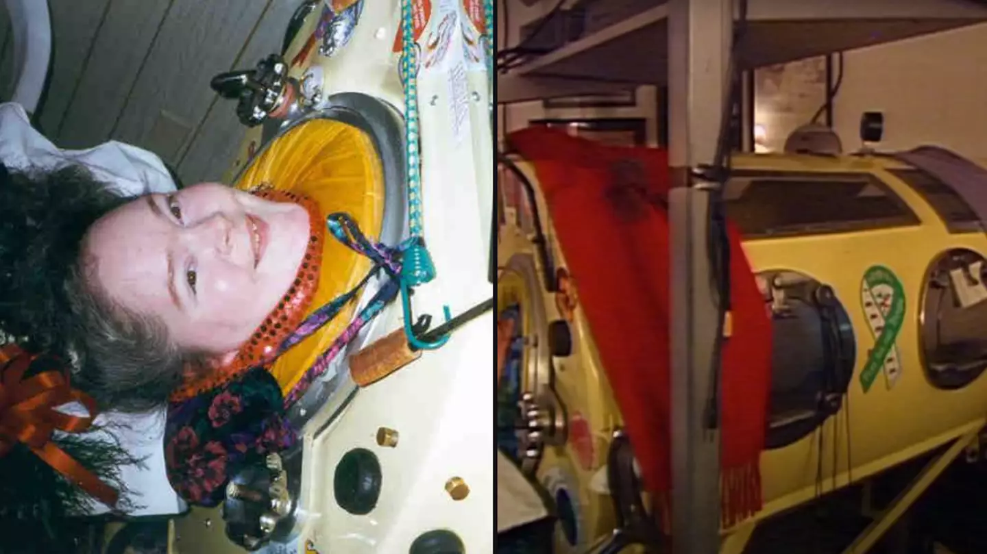 Woman spent 60 years in Iron lung and died in most unfortunate way