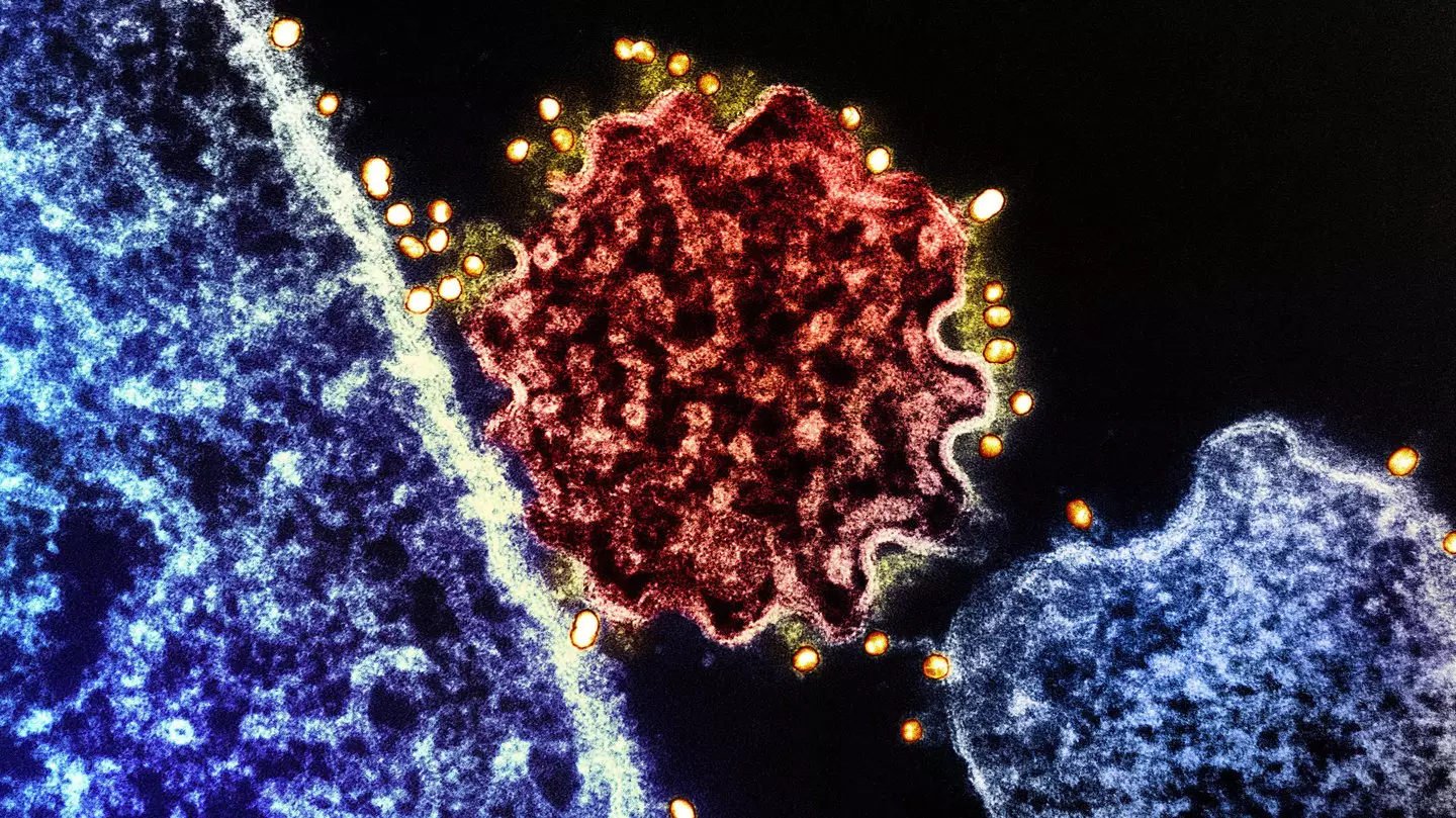 NIH-NIAID/Image Point FR/BSIP/Universal Images Group via Getty Images