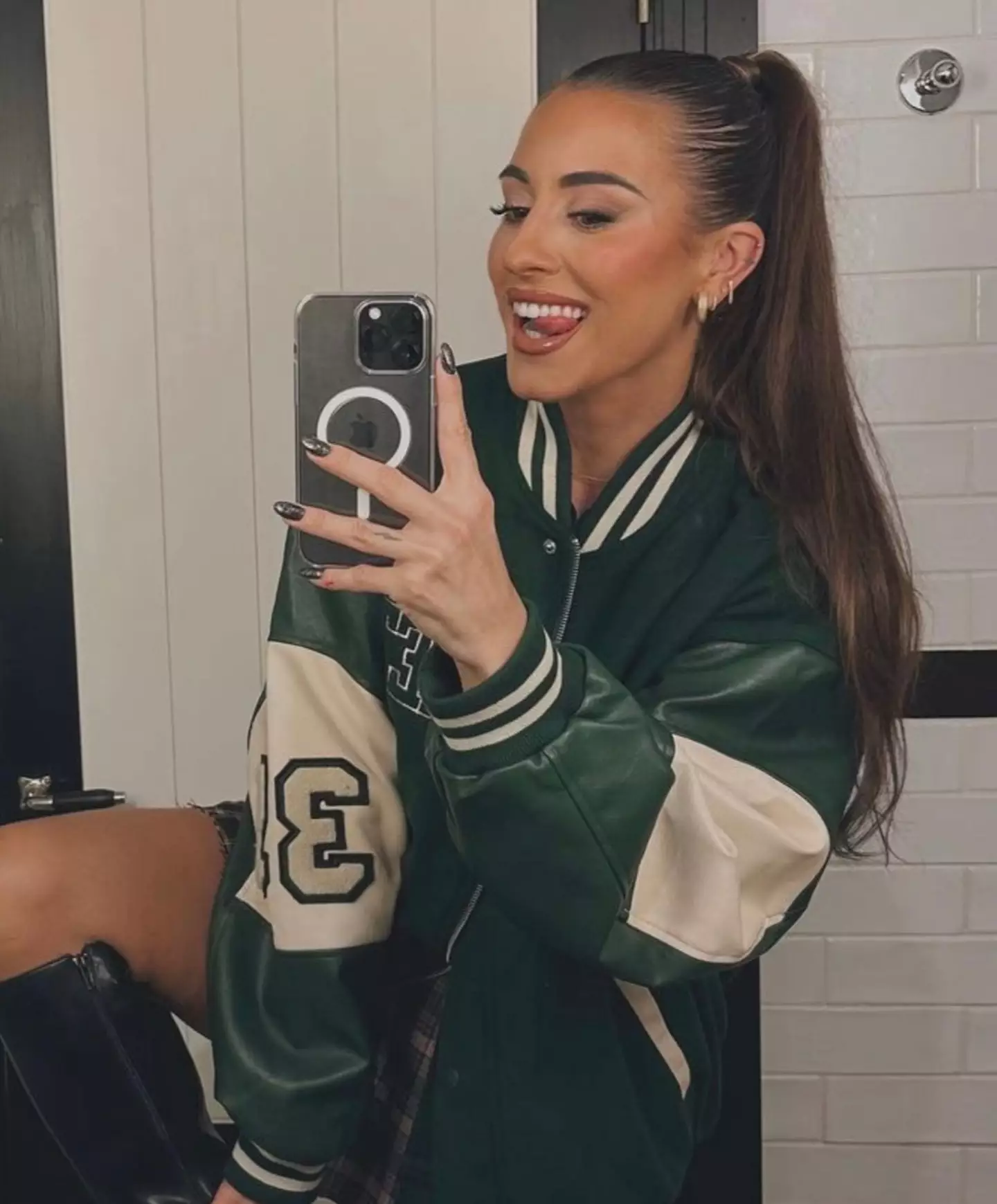 Paula Gonu ate part of her knee.