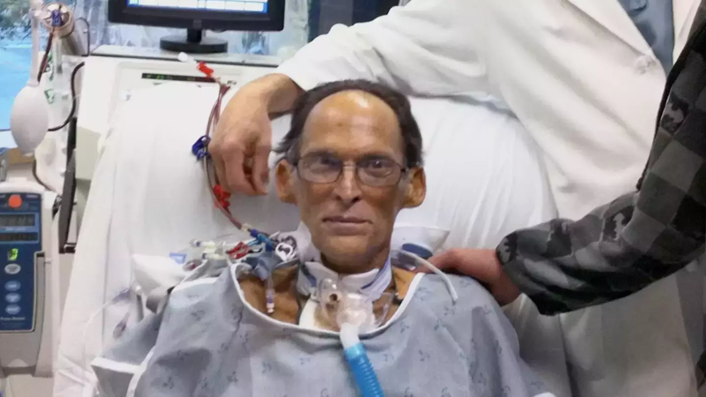 55-year-old Craig Lewis was given 12 hours to live, the device meant he lived for another month.