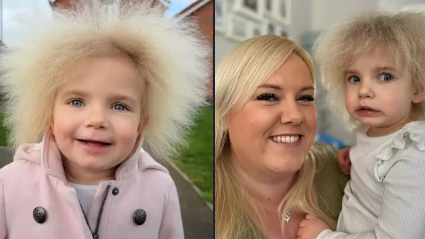 British girl with rare uncombable hair syndrome is one of only 100 in world