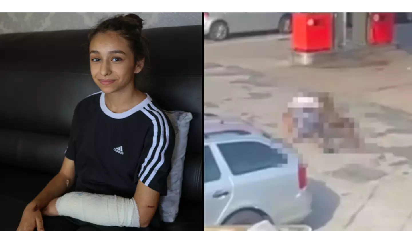 11-year-old who was mauled by XL bully bravely speaks out