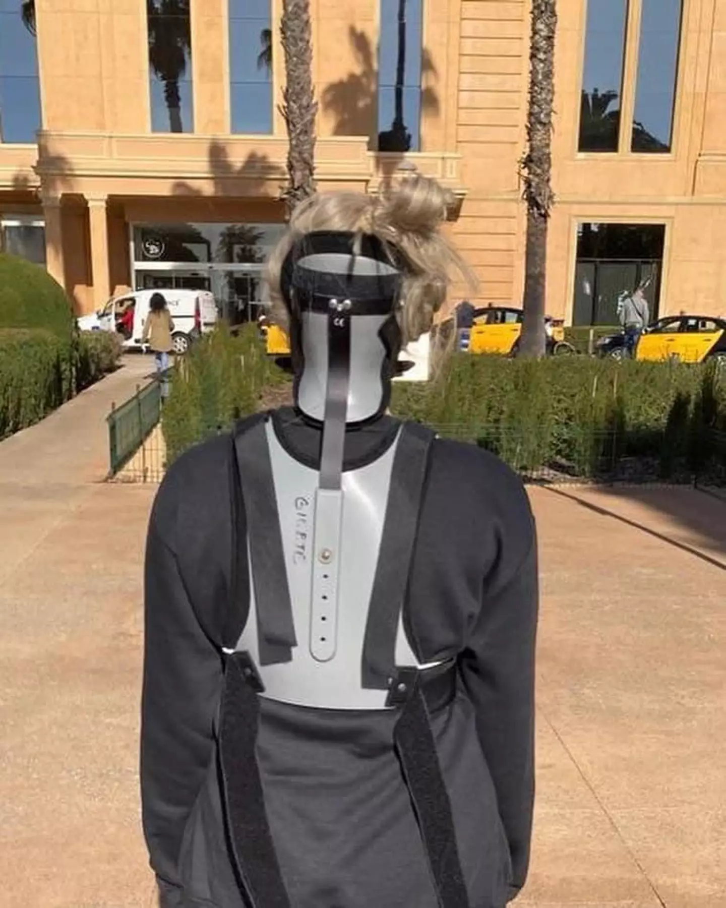 In 2022, she was given the diagnosis that her skull was not securely attached to her spine (Collect/PA Real Life)