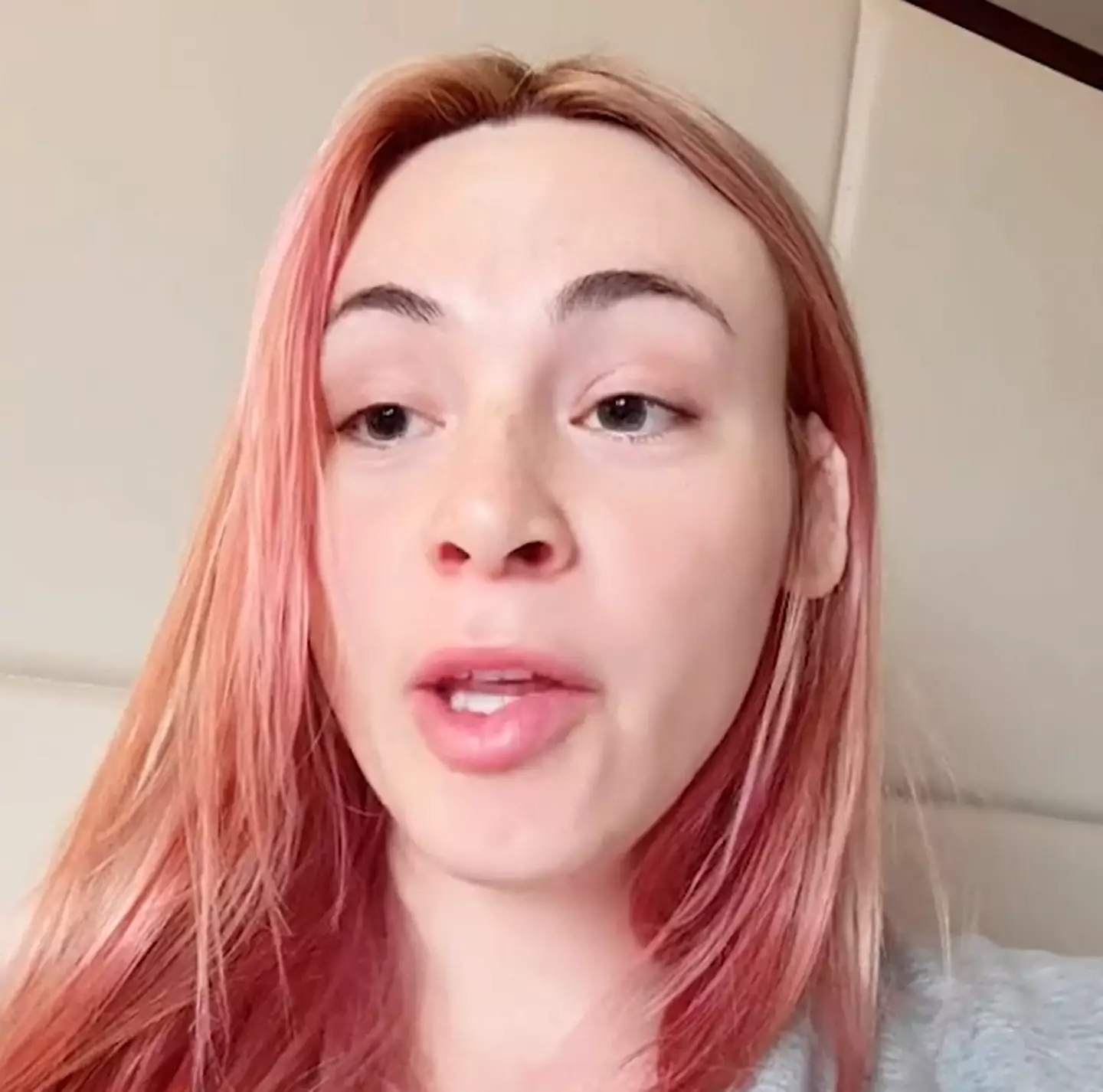 Emily James had six of her ribs removed (EMILY JAMES / CATERS NEWS)