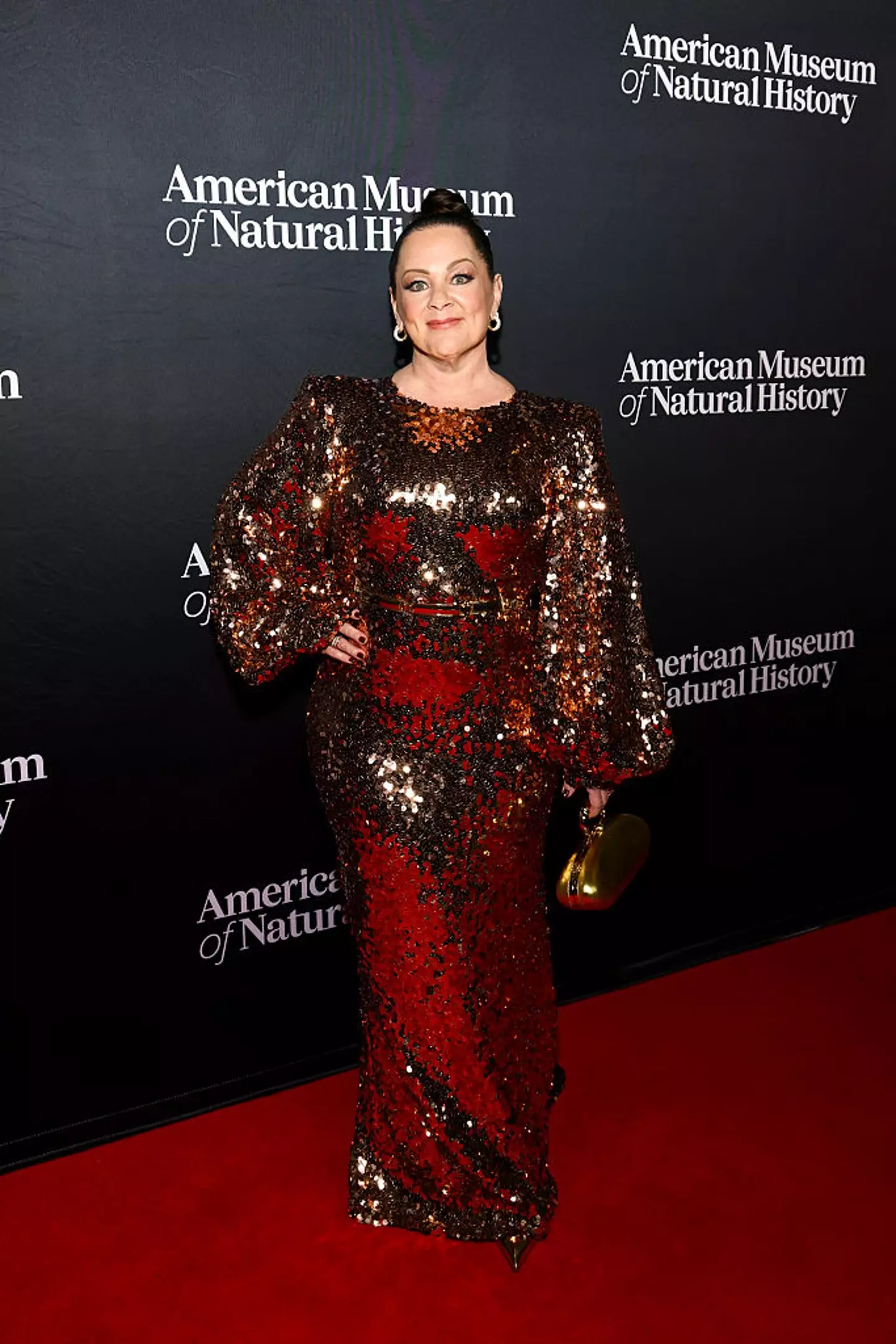 The Bridesmaids star has been candid about her weight loss journey in the past (Stephanie Augello/Variety via Getty Images)