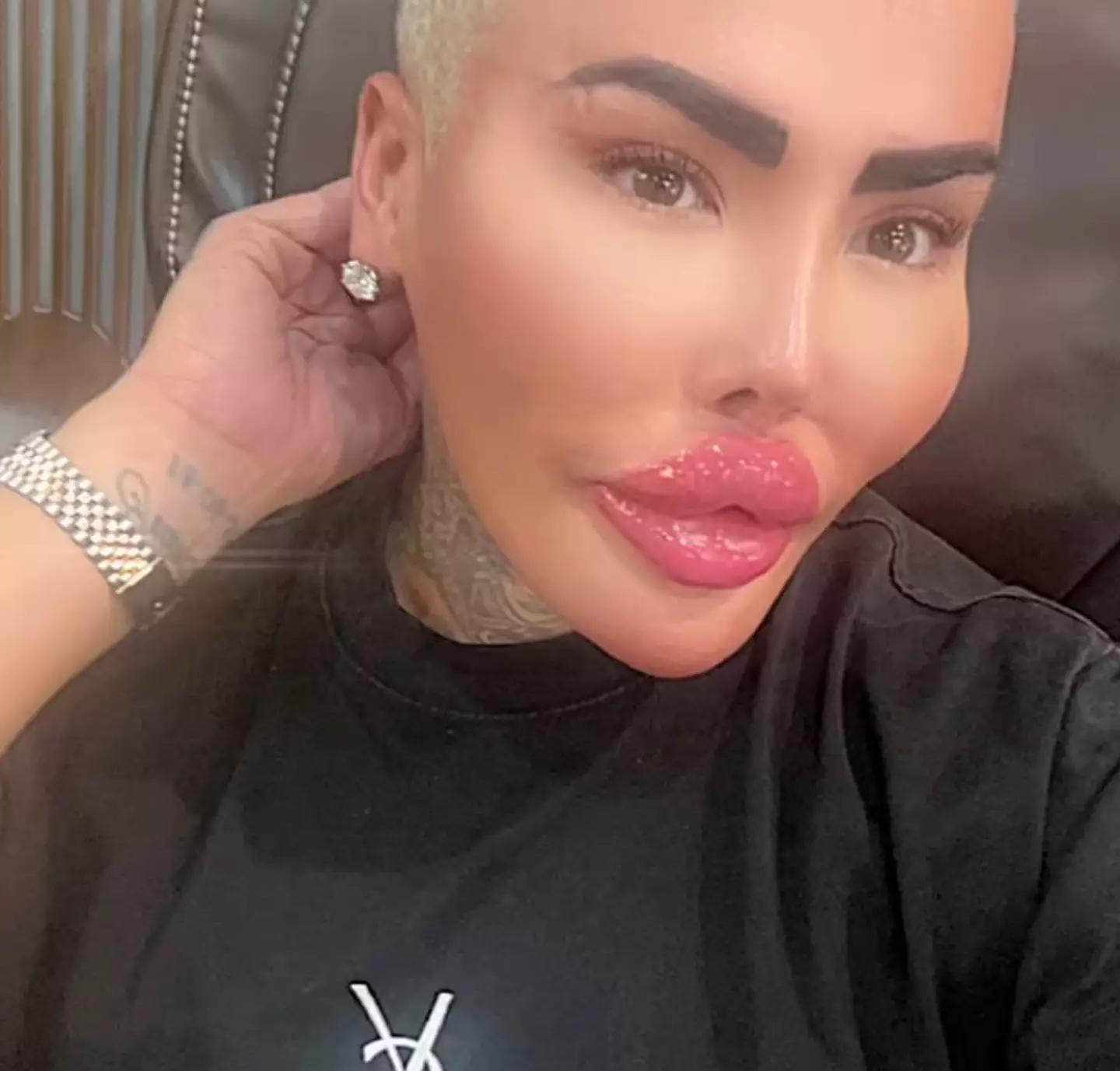 Jordan Parke is known online as the 'Lip King'. (Facebook)