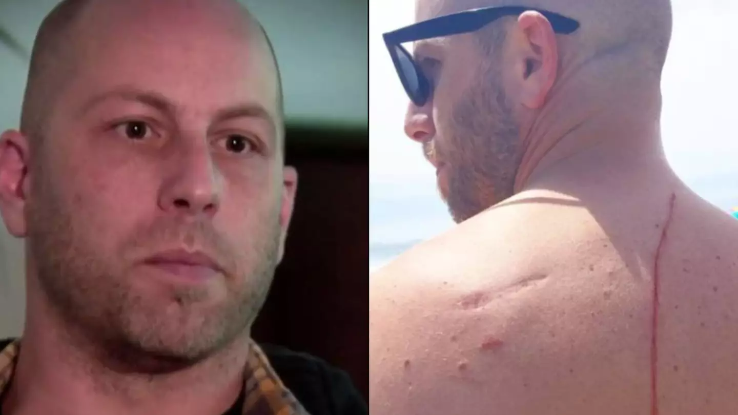 Man Likely Attacked By Shark Ends Up Having His Life Saved By It A Week Later