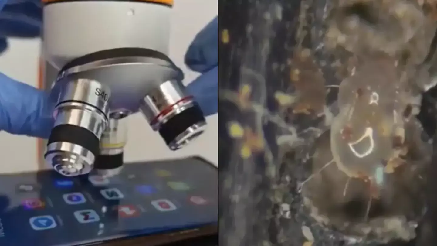 Horrifying footage of phone under a microscope shows grim reality of how dirty they are