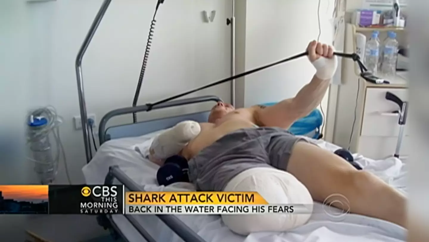 He lost an arm and a leg in the attack.