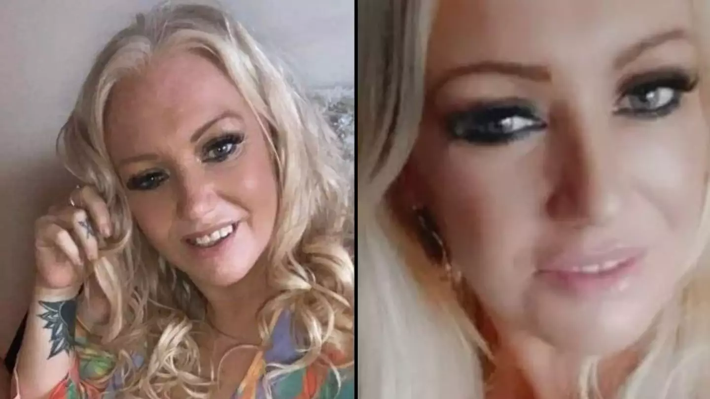 Woman says her 'life is ruined' after sausage dog ripped off her face before eating it in horrific attack